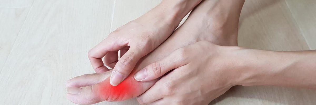 hallux valgus femme